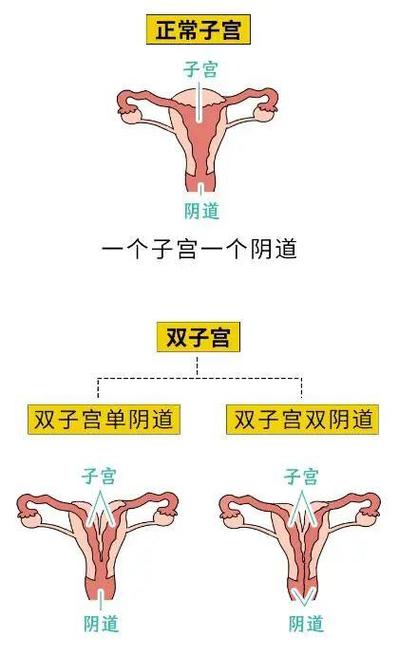 胎宫婚姻 婚姻宫坐胎男